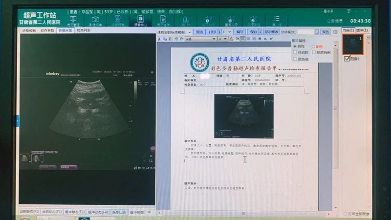 工厂体检套餐批量报价背后的考量因素
